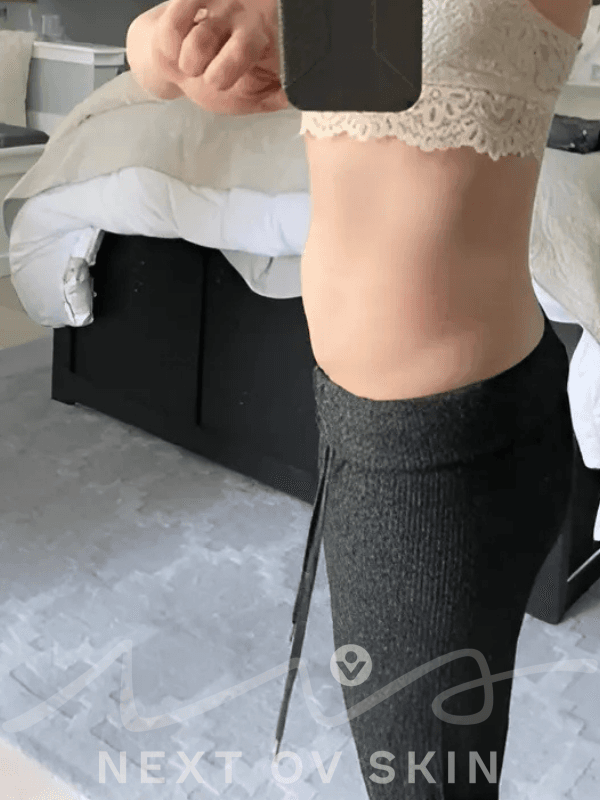 After MomBellyMend treatment - side view