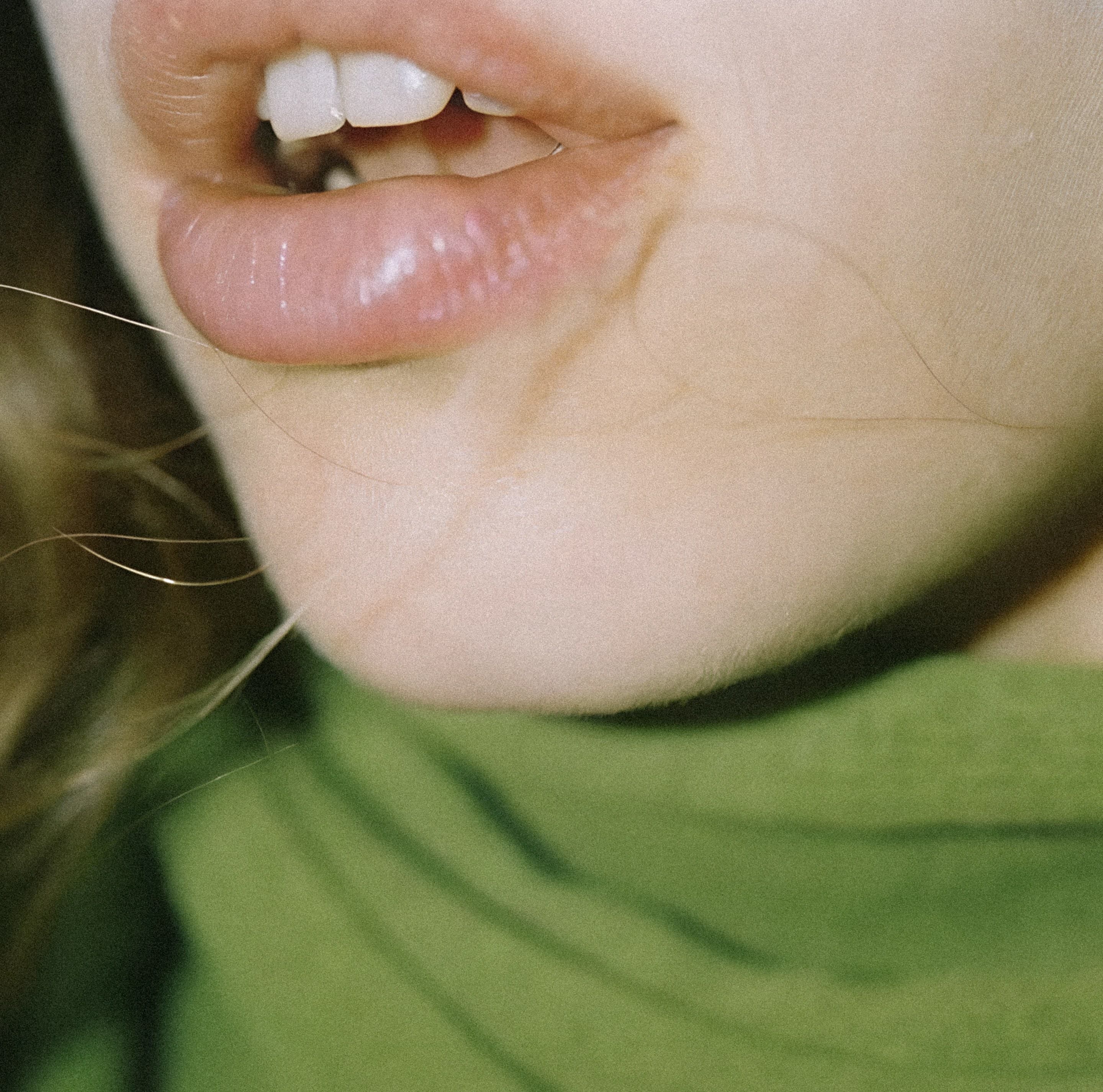 Natural, glossy lips reflecting subtle filler results