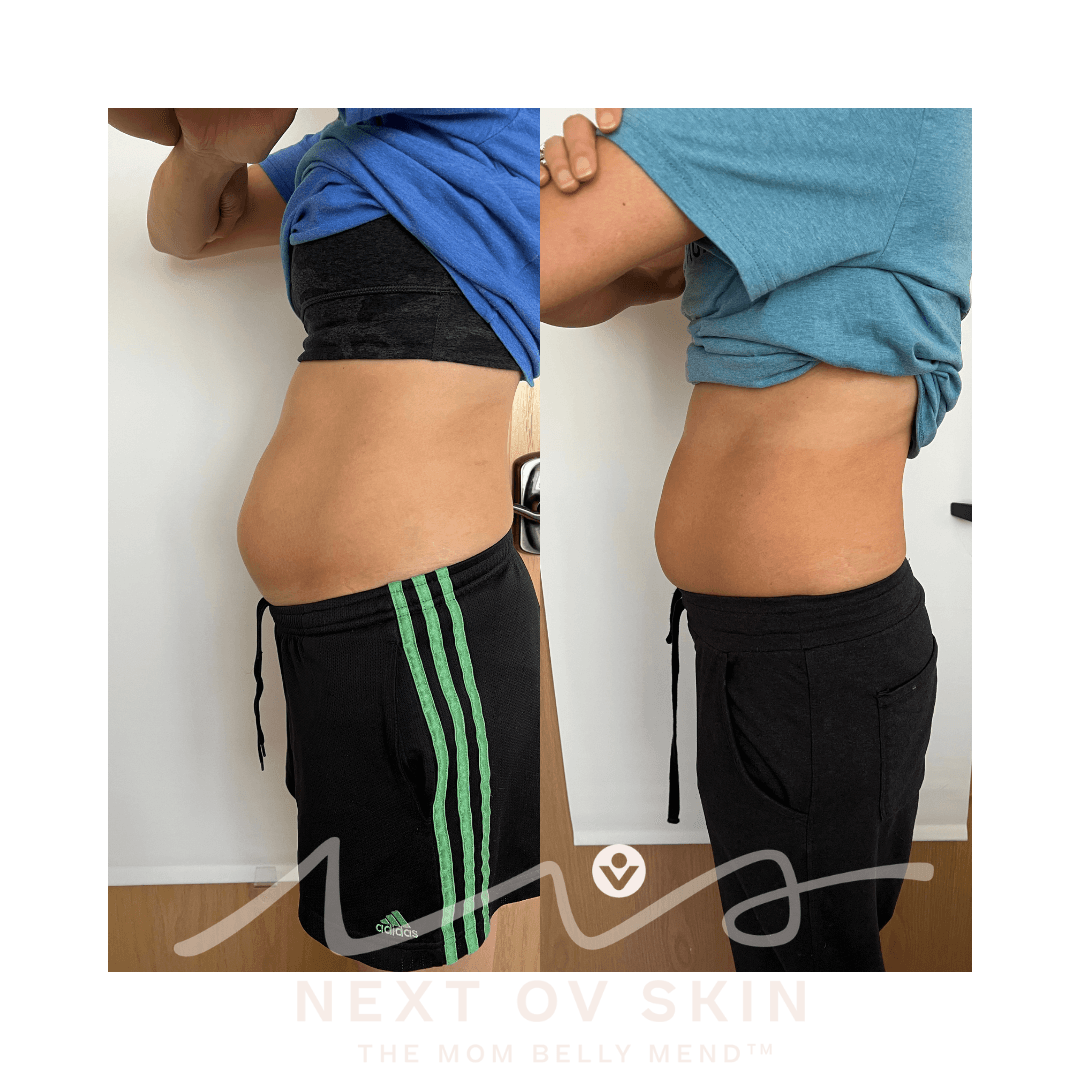 Holistic body transformation before and after treatment series