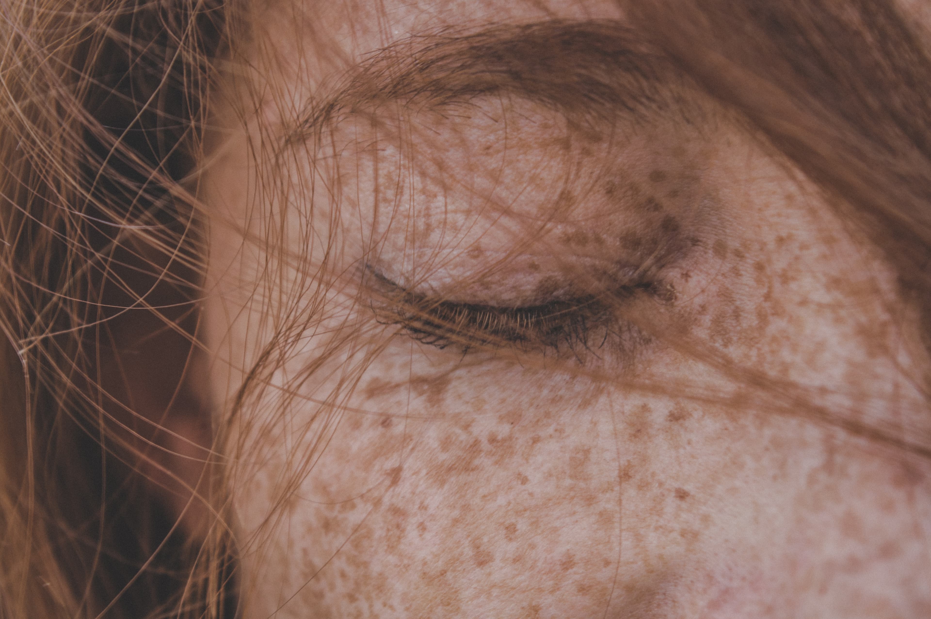 Natural brow and skin after laser microblading removal treatment near Seattle