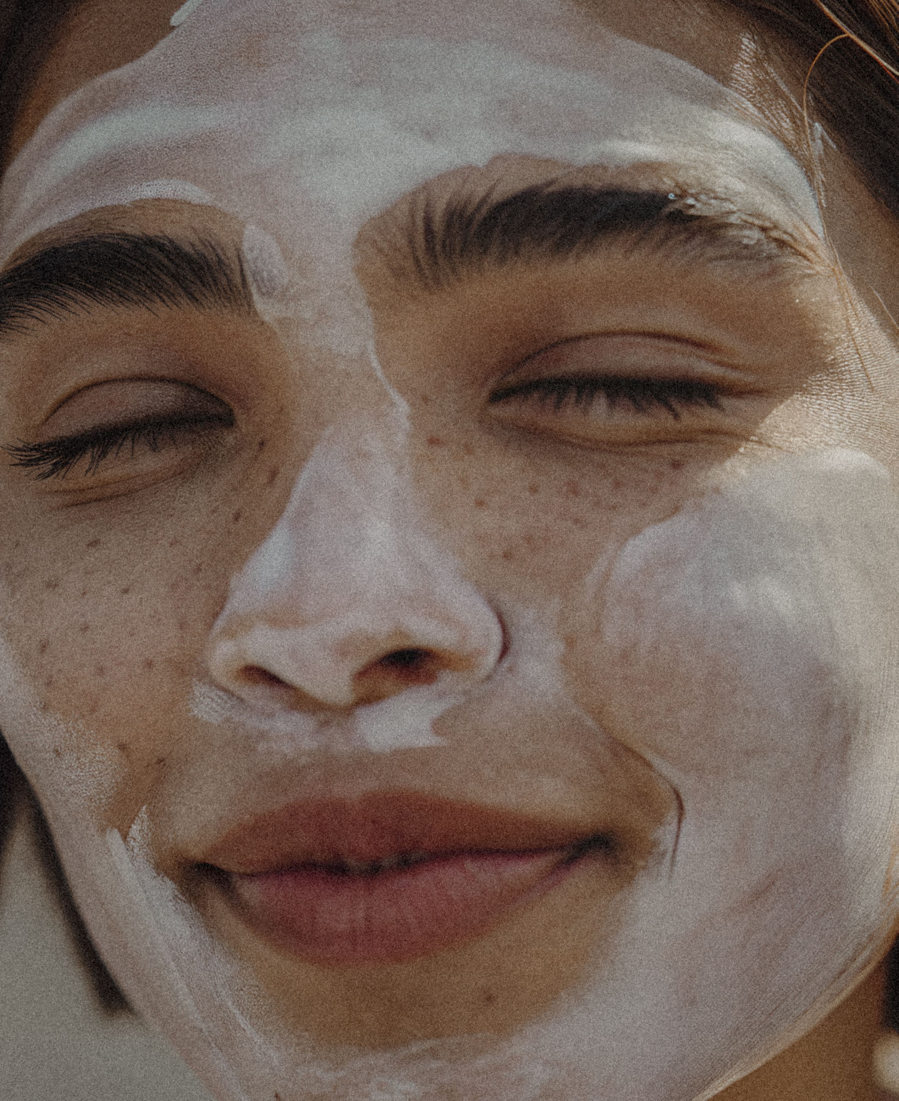 VI Peel® Purify