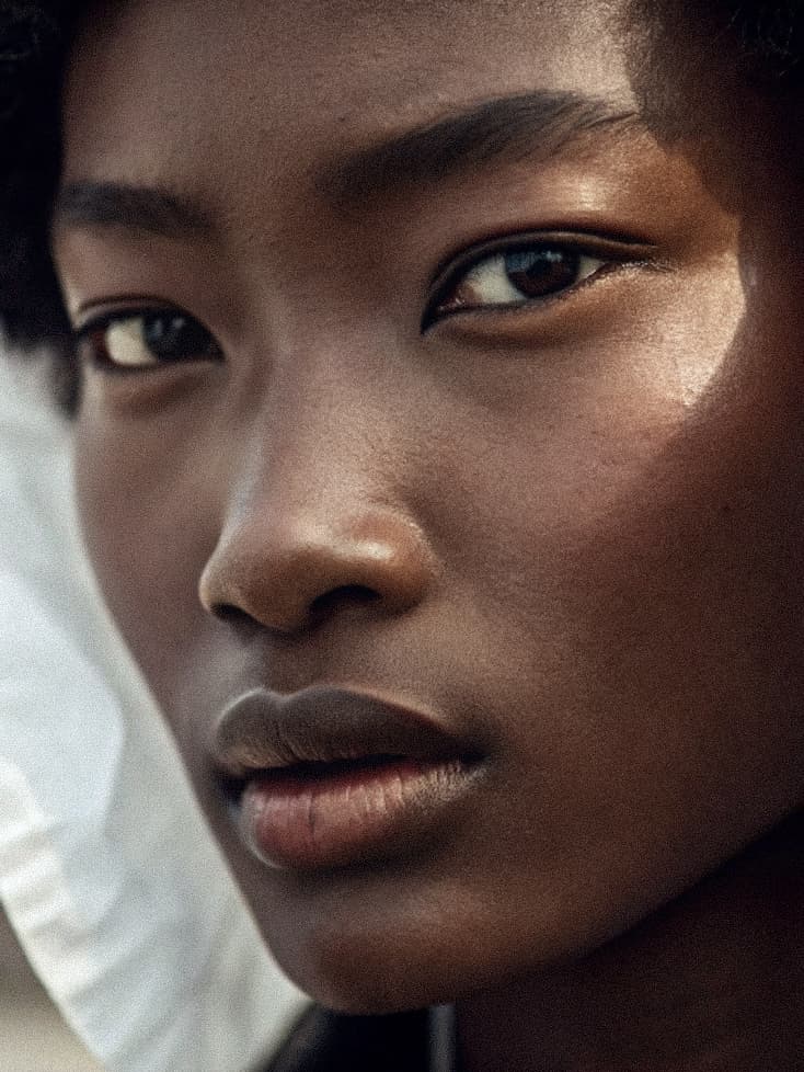 RF Microneedling for Skin Tightening: Your Comprehensive Guide