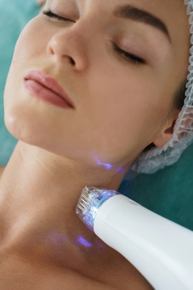 Microneedling treatment for collagen support at Next OV Skin